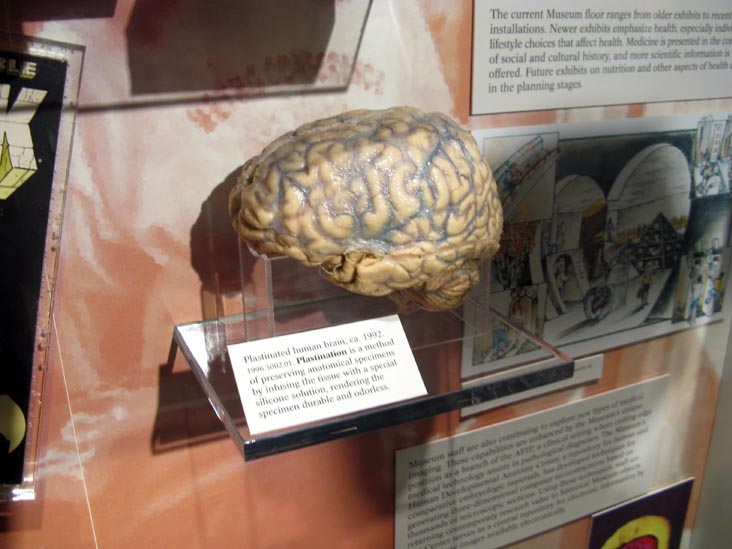 Plastinated Human Brain, National Museum of Health and Medicine, Walter Reed Army Medical Center, 6900 Georgia Avenue NW, Washington, D.C.
