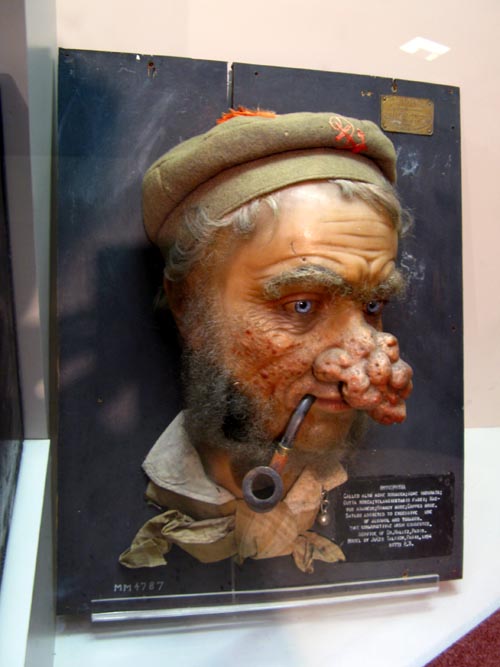 Rhinophyma Display, National Museum of Health and Medicine, Walter Reed Army Medical Center, 6900 Georgia Avenue NW, Washington, D.C.