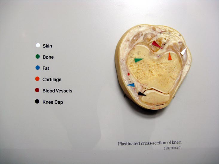 Plastinated Cross-Section of Knee, Human Body, Human Being Exhibit, National Museum of Health and Medicine, Walter Reed Army Medical Center, 6900 Georgia Avenue NW, Washington, D.C.