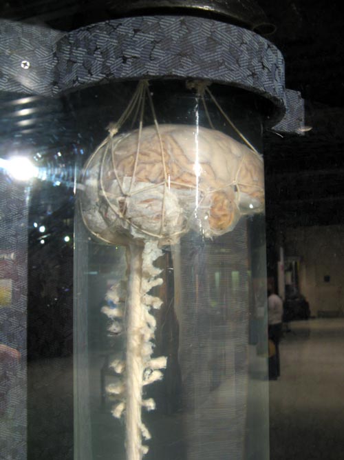 Brain-Spinal Cord, Human Body, Human Being Exhibit, National Museum of Health and Medicine, Walter Reed Army Medical Center, 6900 Georgia Avenue NW, Washington, D.C.