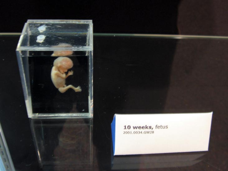 Fetus, 10 Weeks, From a Single Cell Exhibit, National Museum of Health and Medicine, Walter Reed Army Medical Center, 6900 Georgia Avenue NW, Washington, D.C.