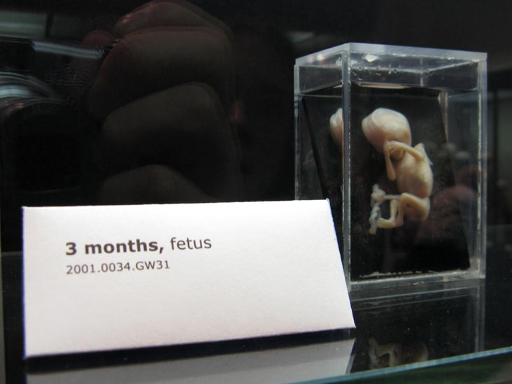 Fetus, 3 Months, From a Single Cell Exhibit, National Museum of Health and Medicine, Walter Reed Army Medical Center, 6900 Georgia Avenue NW, Washington, D.C.