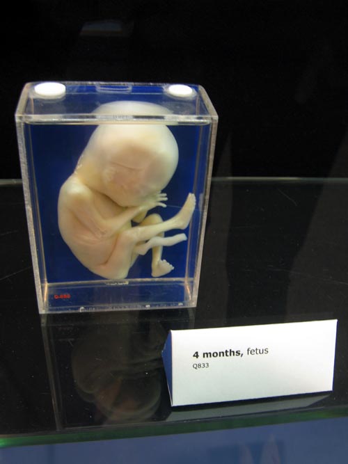 Fetus, 4 Months, From a Single Cell Exhibit, National Museum of Health and Medicine, Walter Reed Army Medical Center, 6900 Georgia Avenue NW, Washington, D.C.