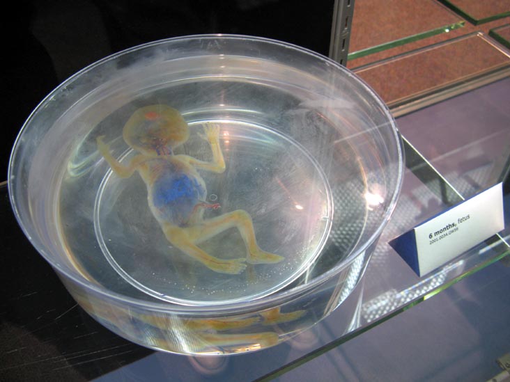 Fetus, 6 Months, From a Single Cell Exhibit, National Museum of Health and Medicine, Walter Reed Army Medical Center, 6900 Georgia Avenue NW, Washington, D.C.