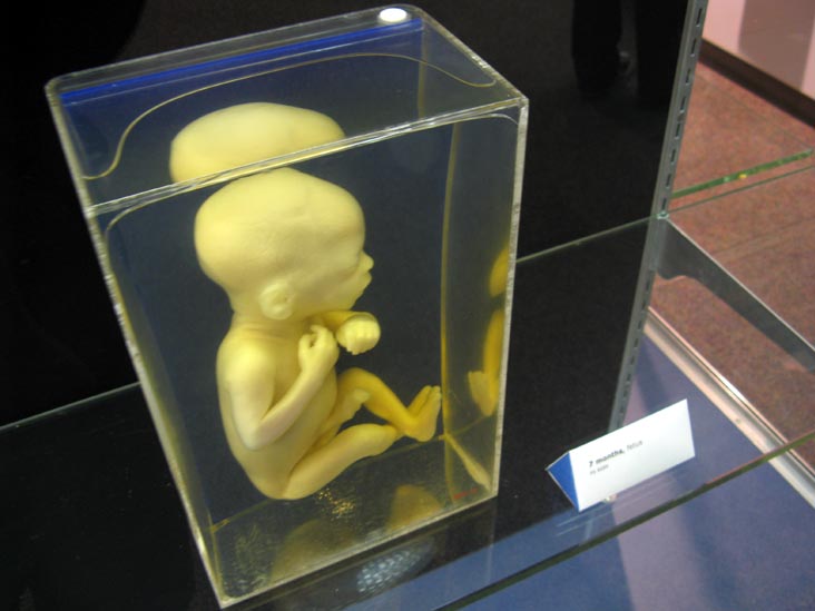 Fetus, 7 Months, From a Single Cell Exhibit, National Museum of Health and Medicine, Walter Reed Army Medical Center, 6900 Georgia Avenue NW, Washington, D.C.