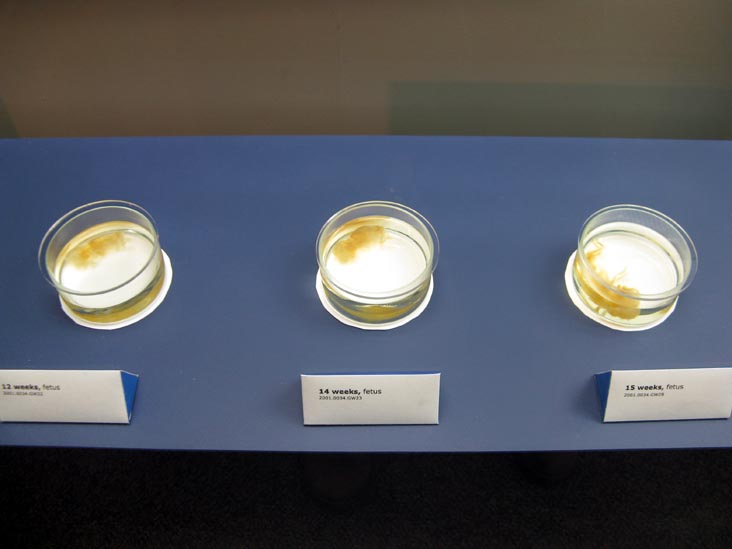 Fetus, 12, 14 and 15 Weeks, From a Single Cell Exhibit, National Museum of Health and Medicine, Walter Reed Army Medical Center, 6900 Georgia Avenue NW, Washington, D.C.