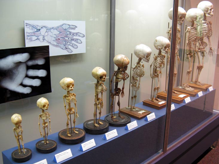 Fetal Skeletons, From a Single Cell Exhibit, National Museum of Health and Medicine, Walter Reed Army Medical Center, 6900 Georgia Avenue NW, Washington, D.C.