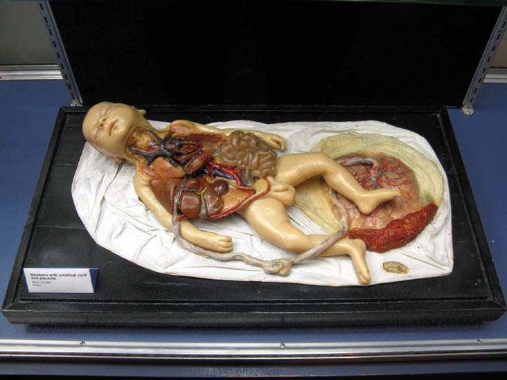 Newborn With Umbilical Cord and Placenta Wax Model, From a Single Cell Exhibit, National Museum of Health and Medicine, Walter Reed Army Medical Center, 6900 Georgia Avenue NW, Washington, D.C.
