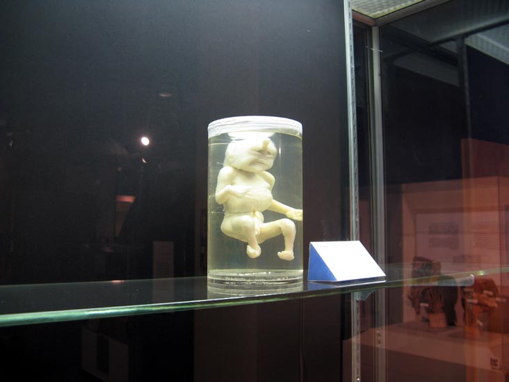 Birth Defect, From a Single Cell Exhibit, National Museum of Health and Medicine, Walter Reed Army Medical Center, 6900 Georgia Avenue NW, Washington, D.C.