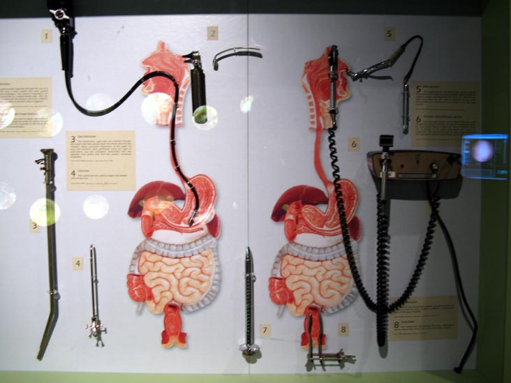 Gastrointestinal Display, National Museum of Health and Medicine, Walter Reed Army Medical Center, 6900 Georgia Avenue NW, Washington, D.C.