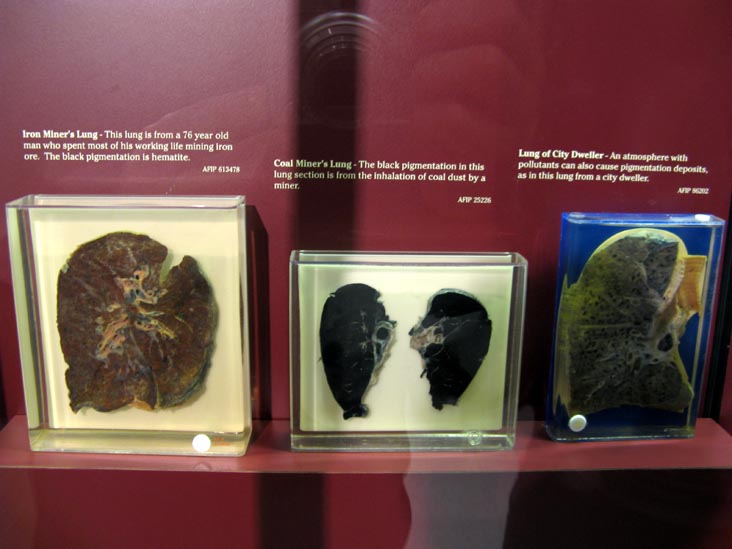 Lungs, Human Body, Human Being Exhibit, National Museum of Health and Medicine, Walter Reed Army Medical Center, 6900 Georgia Avenue NW, Washington, D.C.