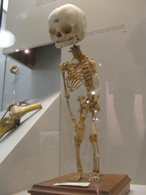 Baby Skeleton, Human Body, Human Being Exhibit, National Museum of Health and Medicine, Walter Reed Army Medical Center, 6900 Georgia Avenue NW, Washington, D.C.