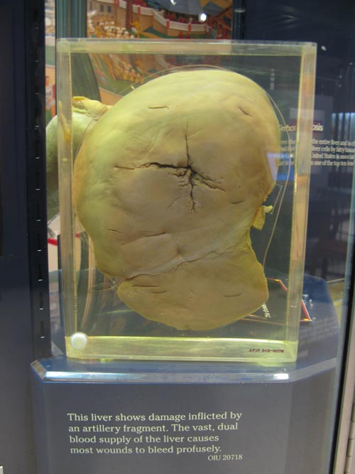 Liver, Human Body, Human Being Exhibit, National Museum of Health and Medicine, Walter Reed Army Medical Center, 6900 Georgia Avenue NW, Washington, D.C.