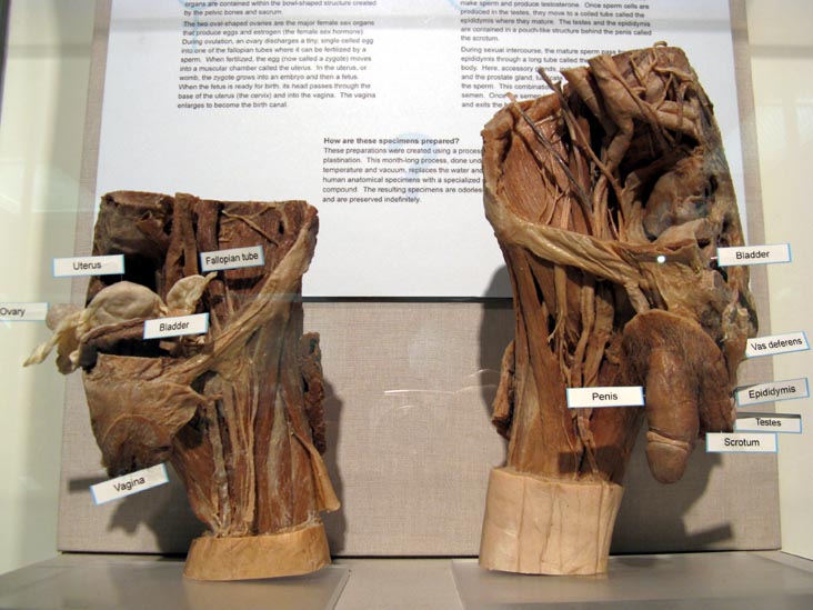 Male and Female Sexual Organs, National Museum of Health and Medicine, Walter Reed Army Medical Center, 6900 Georgia Avenue NW, Washington, D.C.